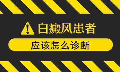 ϵ